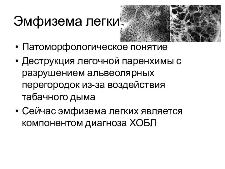 Эмфизема легких Патоморфологическое понятие Деструкция легочной паренхимы с разрушением альвеолярных перегородок из-за