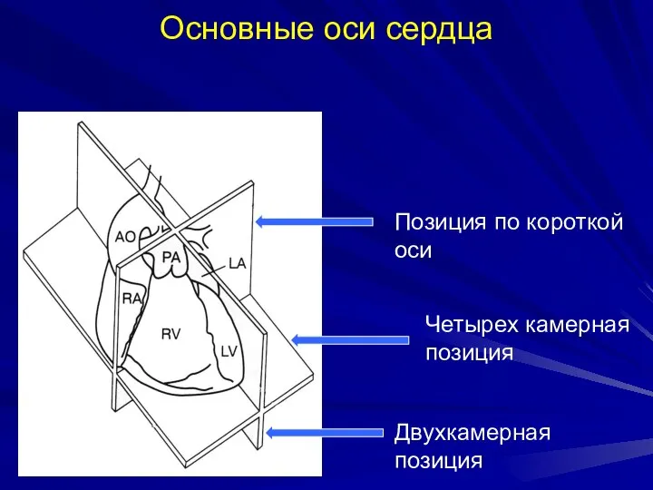 Основные оси сердца Позиция по короткой оси Четырех камерная позиция Двухкамерная позиция