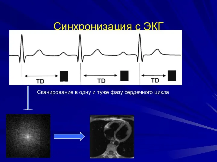 Синхронизация с ЭКГ Сканирование в одну и туже фазу сердечного цикла