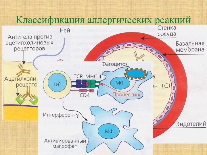 Классификация аллергических реакций