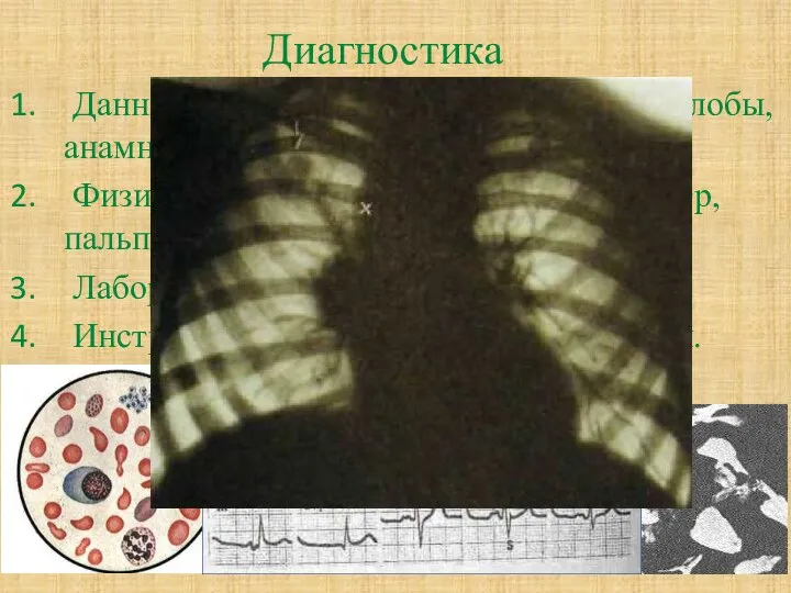 Диагностика Данные субъективного исследования (жалобы, анамнез) Физические методы исследования (осмотр, пальпация, перкуссия,