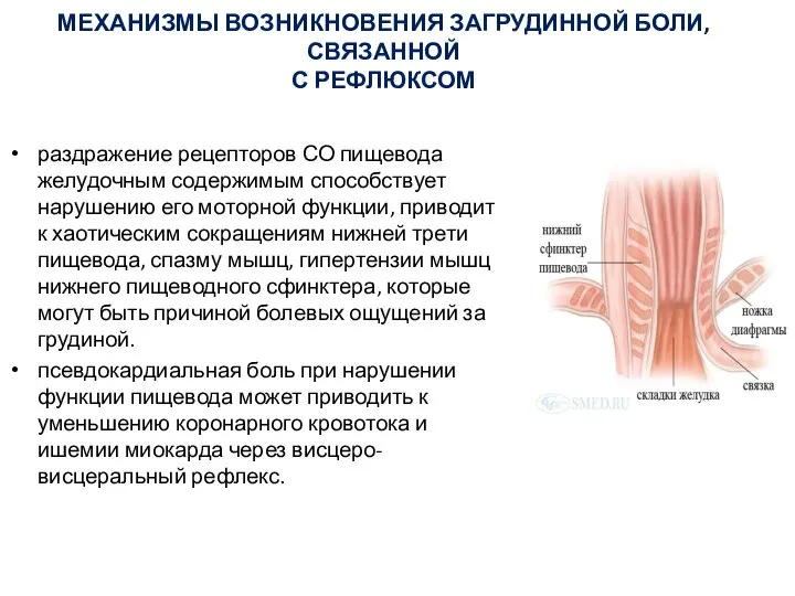 МЕХАНИЗМЫ ВОЗНИКНОВЕНИЯ ЗАГРУДИННОЙ БОЛИ, СВЯЗАННОЙ С РЕФЛЮКСОМ раздражение рецепторов СО пищевода желудочным