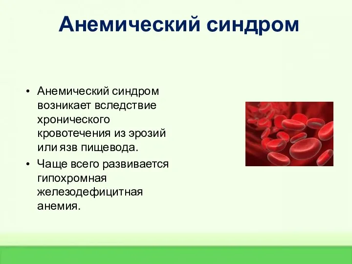 Анемический синдром Анемический синдром возникает вследствие хронического кровотечения из эрозий или язв