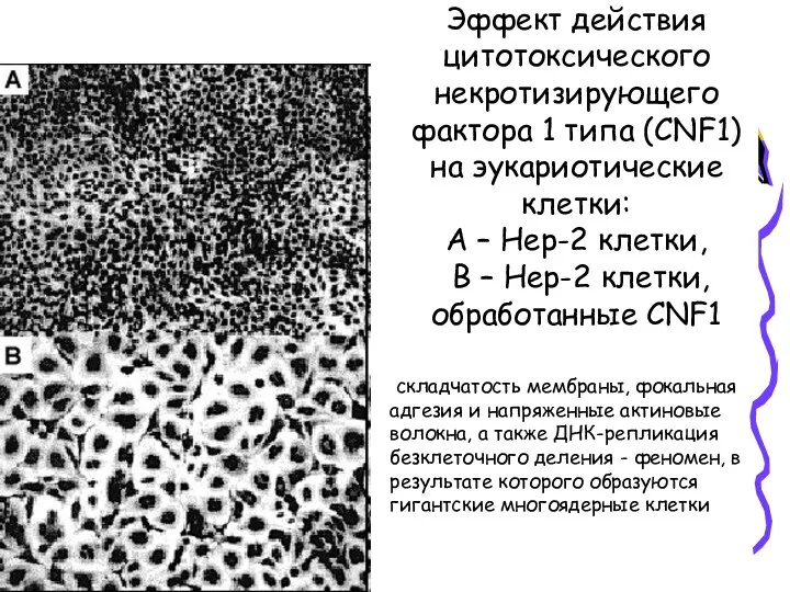 Эффект действия цитотоксического некротизирующего фактора 1 типа (CNF1) на эукариотические клетки: А