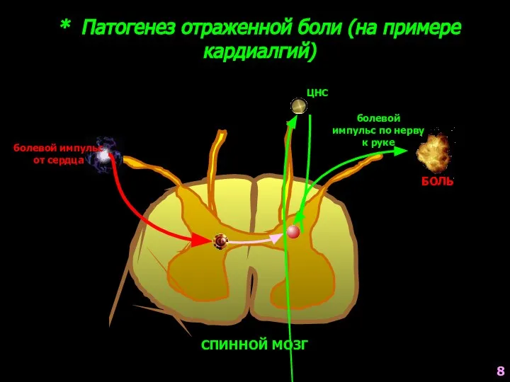 * Патогенез отраженной боли (на примере кардиалгий) болевой импульс по нерву к