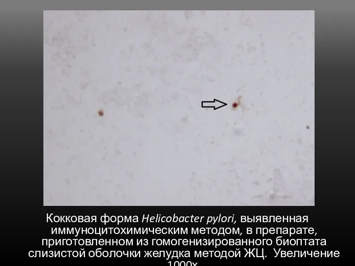Кокковая форма Helicobacter pylori, выявленная иммуноцитохимическим методом, в препарате, приготовленном из гомогенизированного