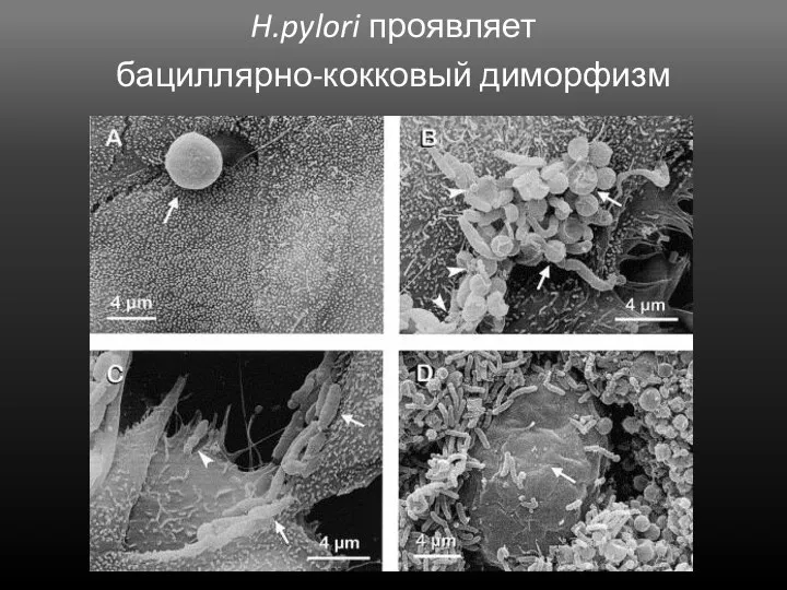 H.pylori проявляет бациллярно-кокковый диморфизм