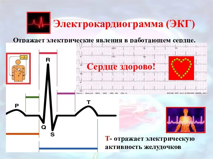 Электрокардиограмма (ЭКГ) Отражает электрические явления в работающем сердце. P- отражает электрическую активность