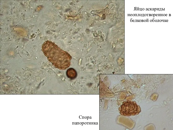 Яйцо аскариды неоплодотворенное в белковой оболочке Спора папоротника