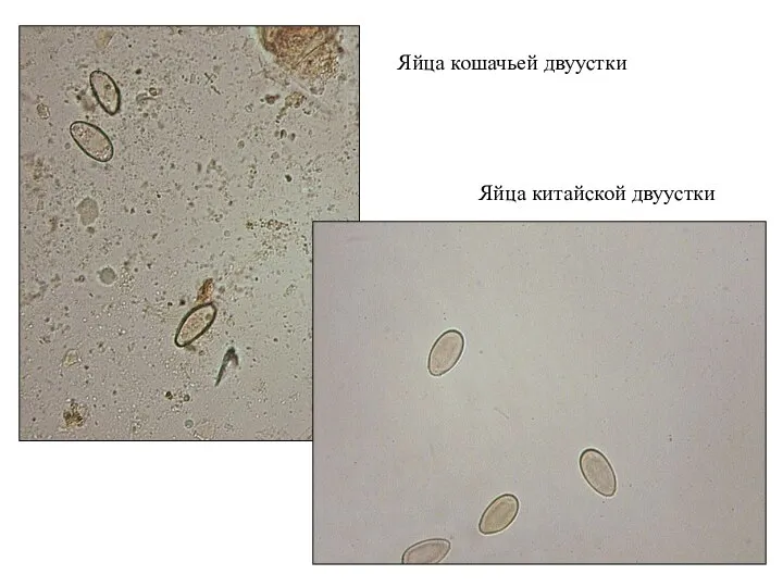 Яйца кошачьей двуустки Яйца китайской двуустки
