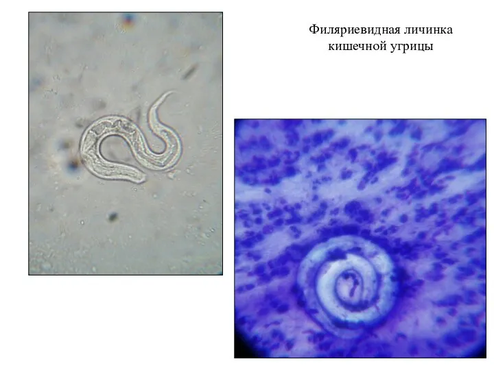 Филяриевидная личинка кишечной угрицы