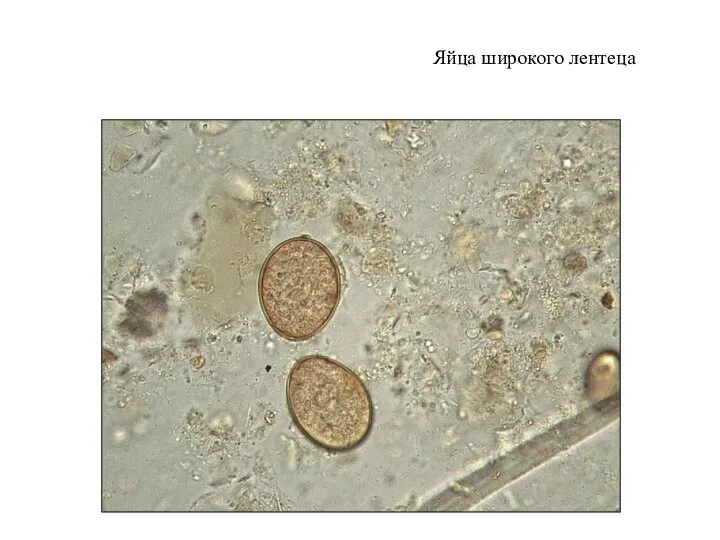 Яйца широкого лентеца