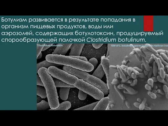 Ботулизм развивается в результате попадания в организм пищевых продуктов, воды или аэрозолей,