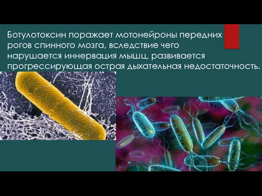 Ботулотоксин поражает мотонейроны передних рогов спинного мозга, вследствие чего нарушается иннервация мышц,