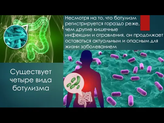 Несмотря на то, что ботулизм регистрируется гораздо реже, чем другие кишечные инфекции