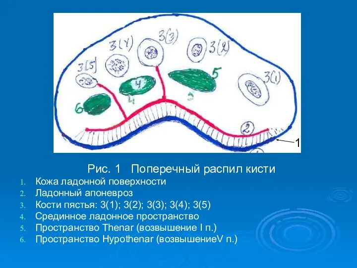 Рис. 1 Поперечный распил кисти Кожа ладонной поверхности Ладонный апоневроз Кости пястья: