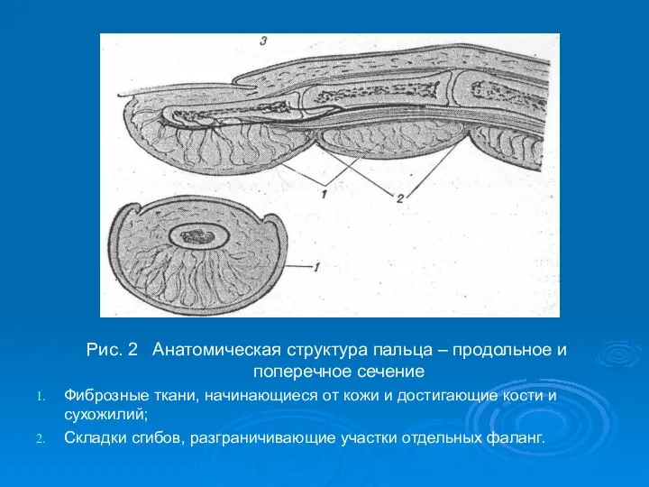 Рис. 2 Анатомическая структура пальца – продольное и поперечное сечение Фиброзные ткани,