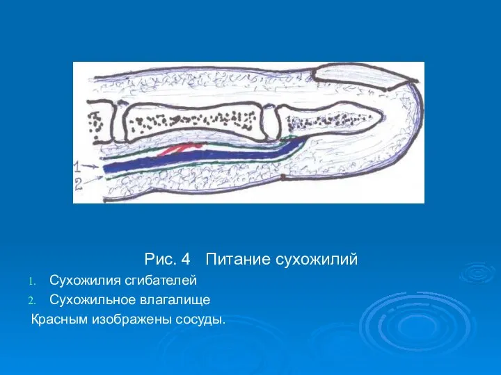 Рис. 4 Питание сухожилий Сухожилия сгибателей Сухожильное влагалище Красным изображены сосуды.