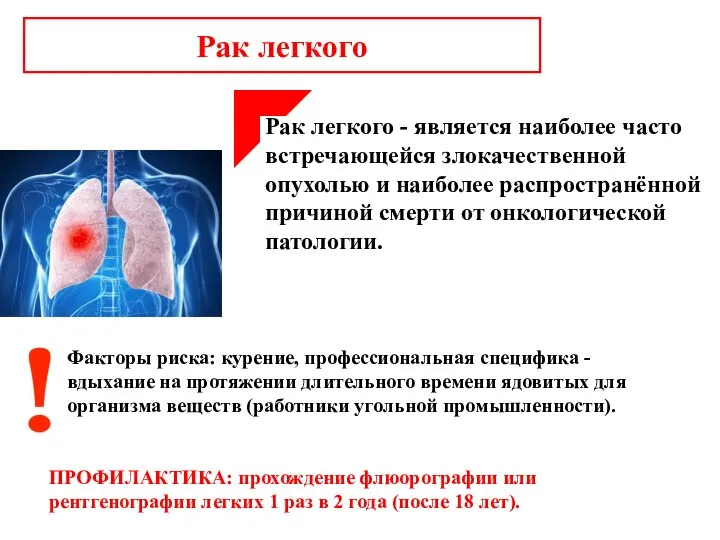 Рак легкого Рак легкого - является наиболее часто встречающейся злокачественной опухолью и