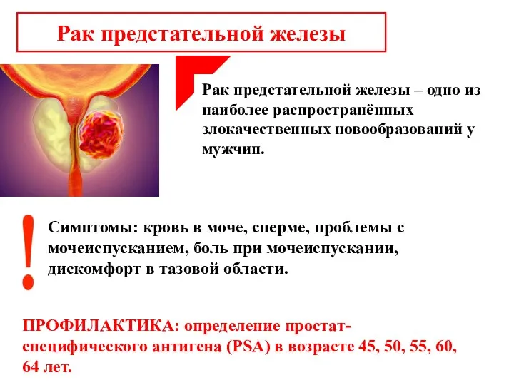 Рак предстательной железы Рак предстательной железы – одно из наиболее распространённых злокачественных