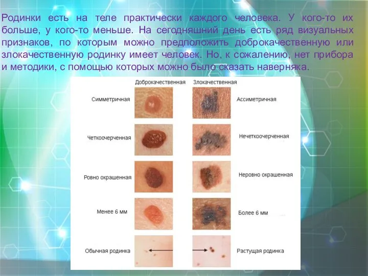Родинки есть на теле практически каждого человека. У кого-то их больше, у