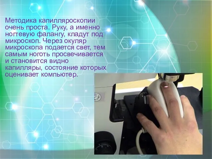 Методика капилляроскопии очень проста. Руку, а именно ногтевую фалангу, кладут под микроскоп.