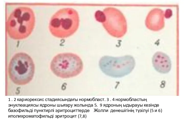 1 . 2 кариорексис стадиясындағы нормобласт. 3 . 4 нормобластың энуклеациясы ядроны