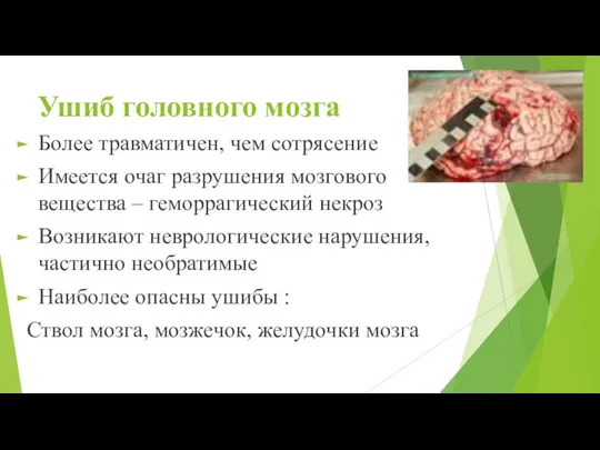 Ушиб головного мозга Более травматичен, чем сотрясение Имеется очаг разрушения мозгового вещества