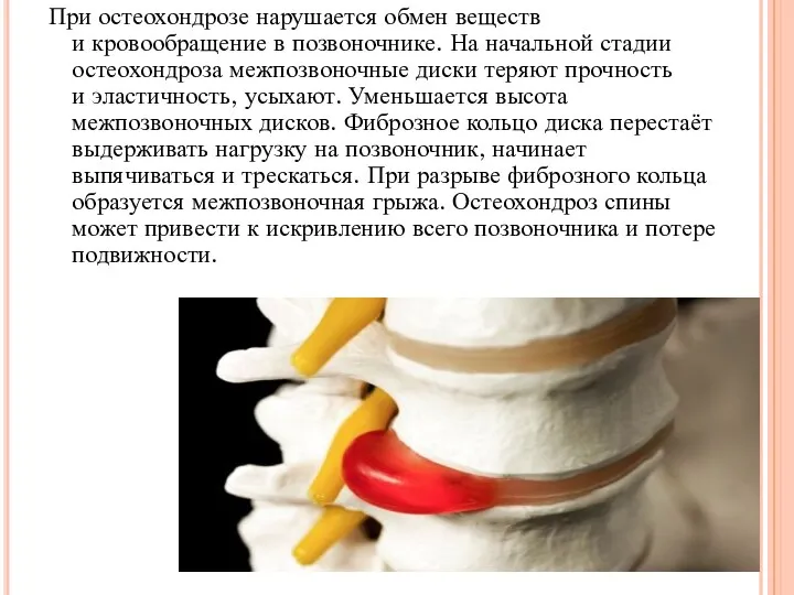 При остеохондрозе нарушается обмен веществ и кровообращение в позвоночнике. На начальной стадии