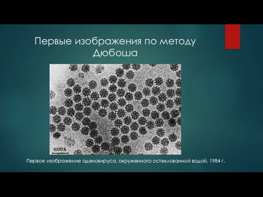Первые изображения по методу Дюбоша Первое изображение аденовируса, окруженного остеклованной водой, 1984 г.