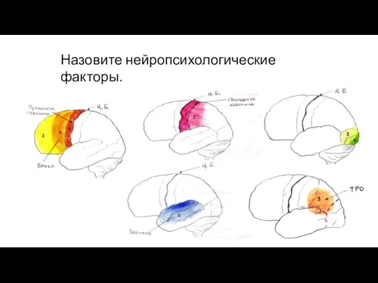 Назовите нейропсихологические факторы.