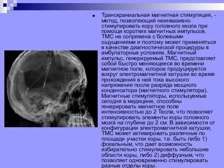 Транскраниальная магнитная стимуляция, - метод, позволяющий неинвазивно стимулировать кору головного мозга при