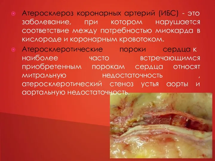 Атеросклероз коронарных артерий (ИБС) - это заболевание, при котором нарушается соответствие между