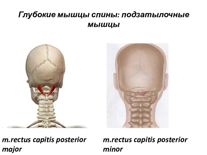 Глубокие мышцы спины: подзатылочные мышцы m.rectus capitis posterior major m.rectus capitis posterior minor