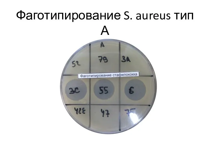 Фаготипирование S. aureus тип А