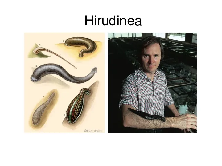 Hirudinea