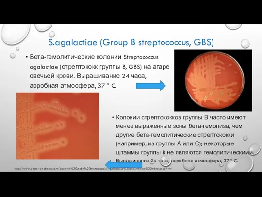 S.agalactiae (Group B streptococcus, GBS) Бета-гемолитические колонии Streptococcus agalactiae (стрептококк группы B,