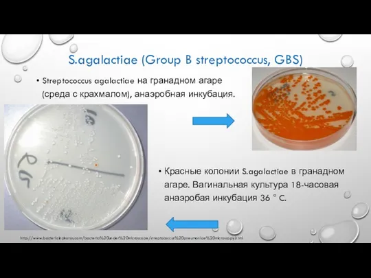 S.agalactiae (Group B streptococcus, GBS) Streptococcus agalactiae на гранадном агаре (среда с