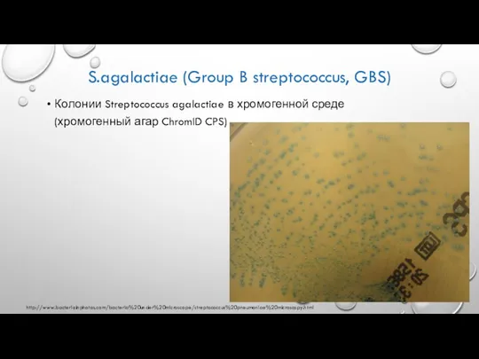 S.agalactiae (Group B streptococcus, GBS) Колонии Streptococcus agalactiae в хромогенной среде (хромогенный агар ChromID CPS) http://www.bacteriainphotos.com/bacteria%20under%20microscope/streptococcus%20pneumoniae%20microscopy.html