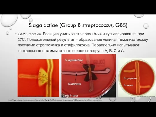 S.agalactiae (Group B streptococcus, GBS) CAMP reaction. Реакцию учитывают через 18-24 ч