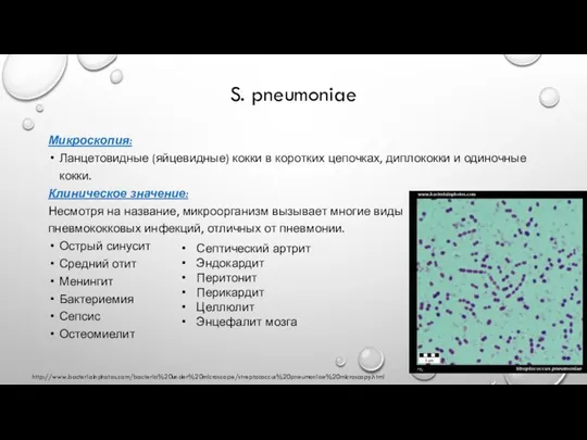 S. pneumoniae Микроскопия: Ланцетовидные (яйцевидные) кокки в коротких цепочках, диплококки и одиночные