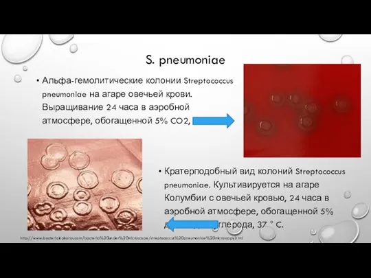 S. pneumoniae Альфа-гемолитические колонии Streptococcus pneumoniae на агаре овечьей крови. Выращивание 24