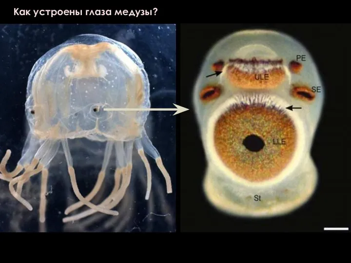 Как устроены глаза медузы?