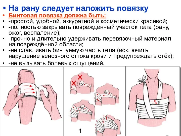 На рану следует наложить повязку Бинтовая повязка должна быть: -простой, удобной, аккуратной