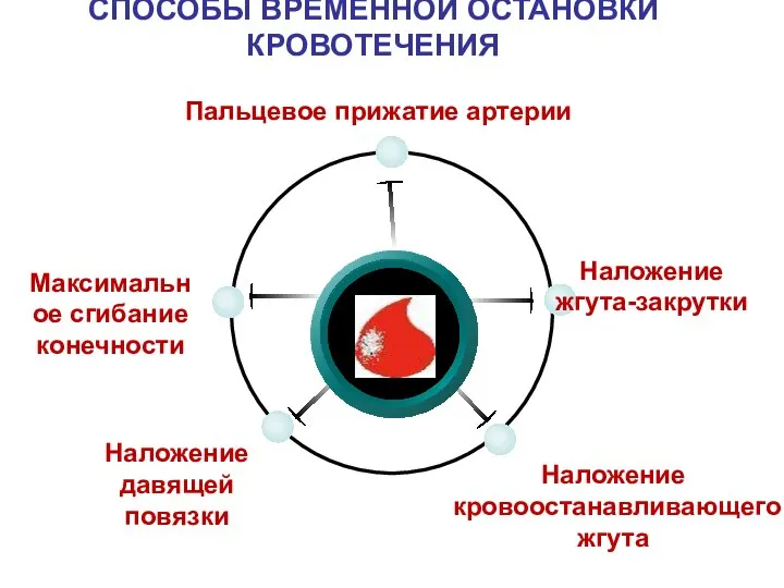 СПОСОБЫ ВРЕМЕННОЙ ОСТАНОВКИ КРОВОТЕЧЕНИЯ Пальцевое прижатие артерии Наложение жгута-закрутки Наложение кровоостанавливающего жгута