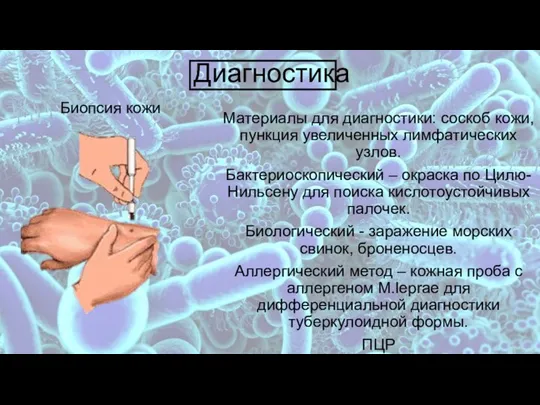 Диагностика Материалы для диагностики: соскоб кожи, пункция увеличенных лимфатических узлов. Бактериоскопический –