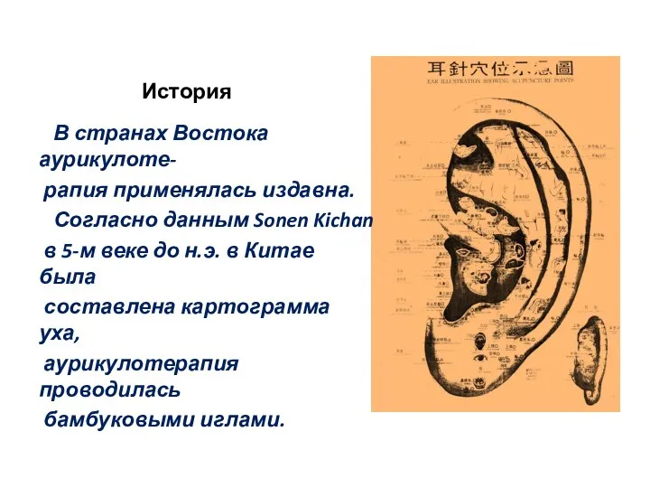 История В странах Востока аурикулоте- рапия применялась издавна. Согласно данным Sonen Kichan