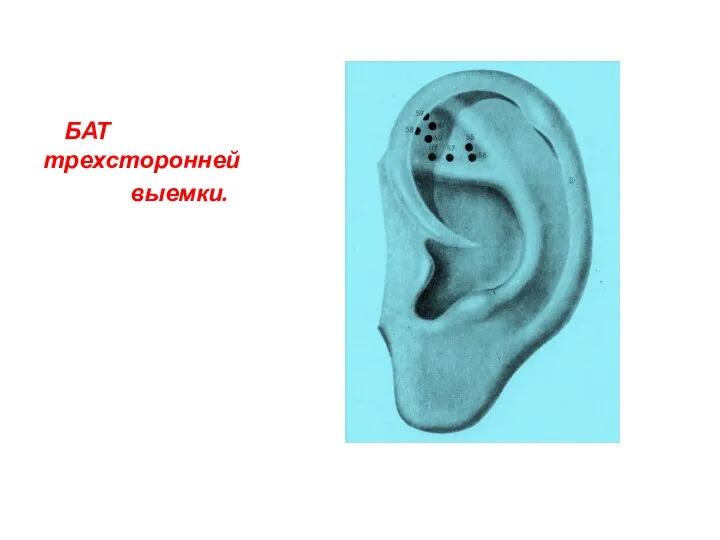 БАТ трехсторонней выемки.