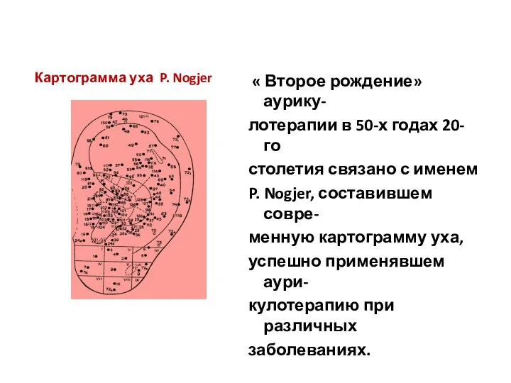 Картограмма уха P. Nogjer « Второе рождение» аурику- лотерапии в 50-х годах