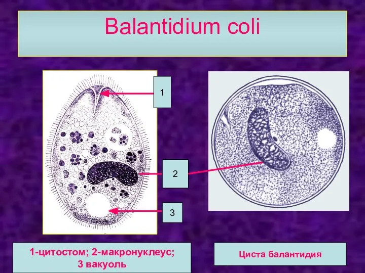 Balantidium coli 1 2 3 1-цитостом; 2-макронуклеус; 3 вакуоль Циста балантидия